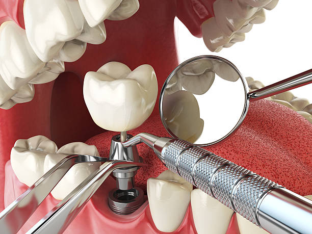 Best Emergency Dental Care for Abscessed Tooth in Northport, AL